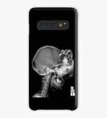 Infected X-Ray Case/Skin for Samsung Galaxy