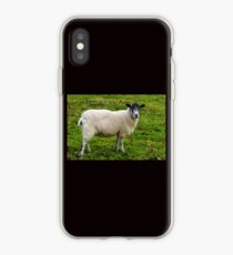 I.m Watching Ewe.......... iPhone Case