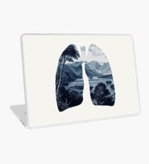 Fresh Laptop Skin