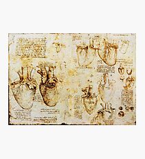 Heart And Its Blood Vessels Photographic Print