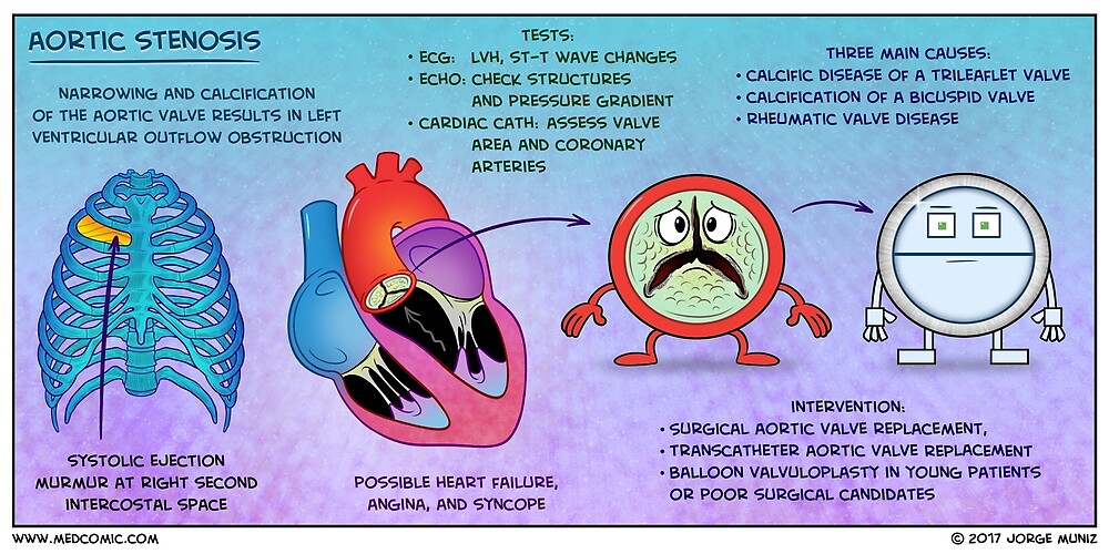 aortic-regurgitation-what-is-it-causes-diagnosis-treatment-and