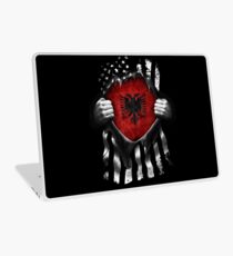 Albanische amerikanische Flagge. Albanien Nationalflagge Laptop Skin