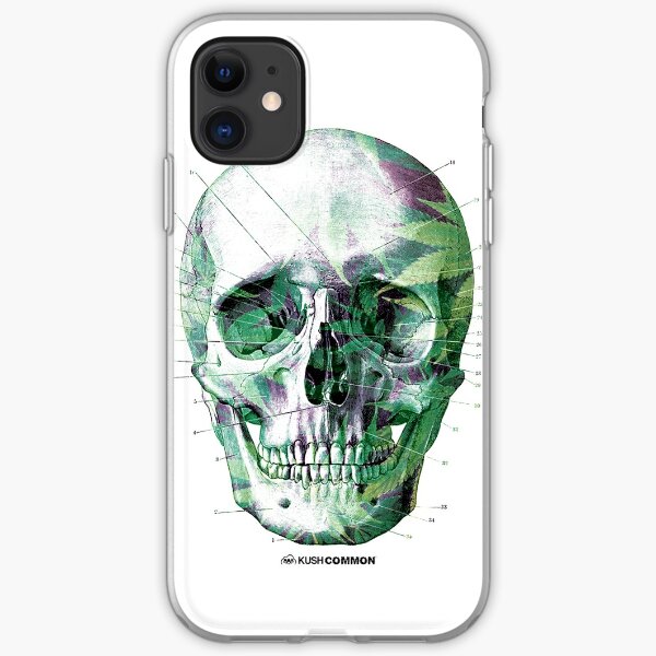 Pot Head iPhone Soft Case
