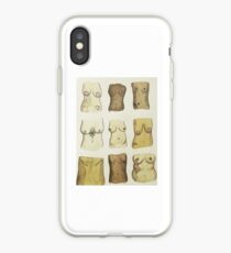 Free ALL nipples iPhone Case