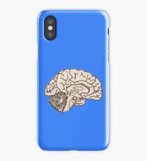 hemisected brain iPhone Case