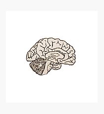 hemisected brain Photographic Print
