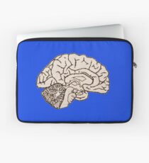 hemisected brain Laptop Sleeve