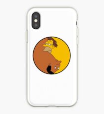 Duality - Lenny & Carl iPhone Case
