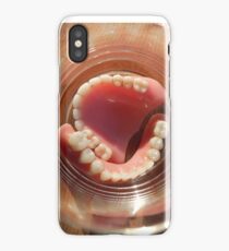 denture jaw gum iPhone Case/Skin