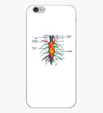 Hemangioblastoma on the Wall iPhone Case