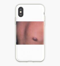 Nipples iPhone Case