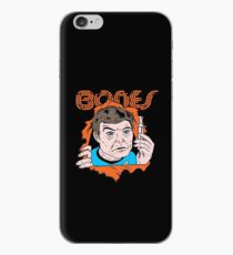 Bones parody iPhone Case