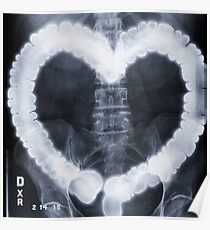 COLONHEART — XRAY Poster