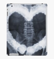 COLONHEART — XRAY iPad Case/Skin