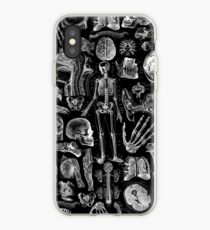 Human Anatomy Black Print iPhone Case