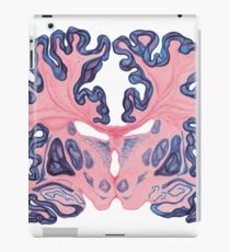 Gyri und Wirbel des menschlichen Gehirns iPad-Hülle & Skin