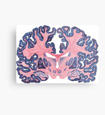 Gyri and Swirls of Human Brain Metal Print