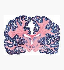 Lámina fotográfica Gyri y remolinos del cerebro humano