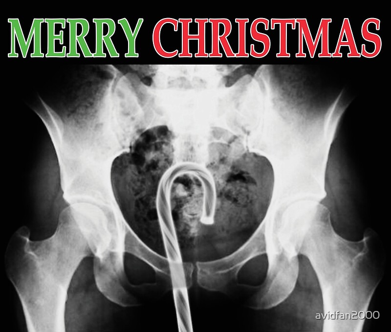 &quot;X-Ray Merry Christmas Candy Cane&quot; by avidfan2000 | Redbubble