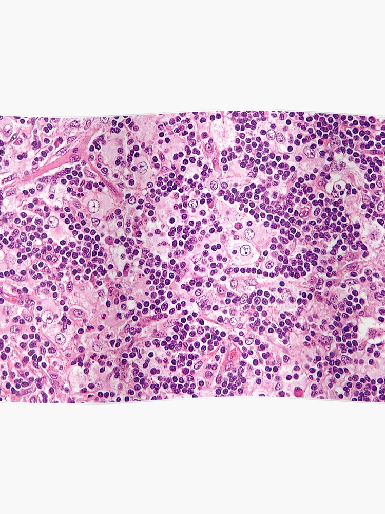 Nodulos linfaticos histologia