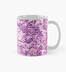 Lymphknotenhistologie Tasse (Standard)