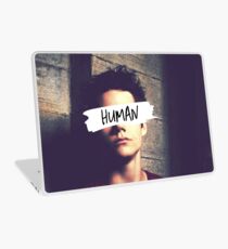 Stiles Stilinski | Human Laptop Skin