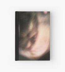 Angry face Hardcover Journal