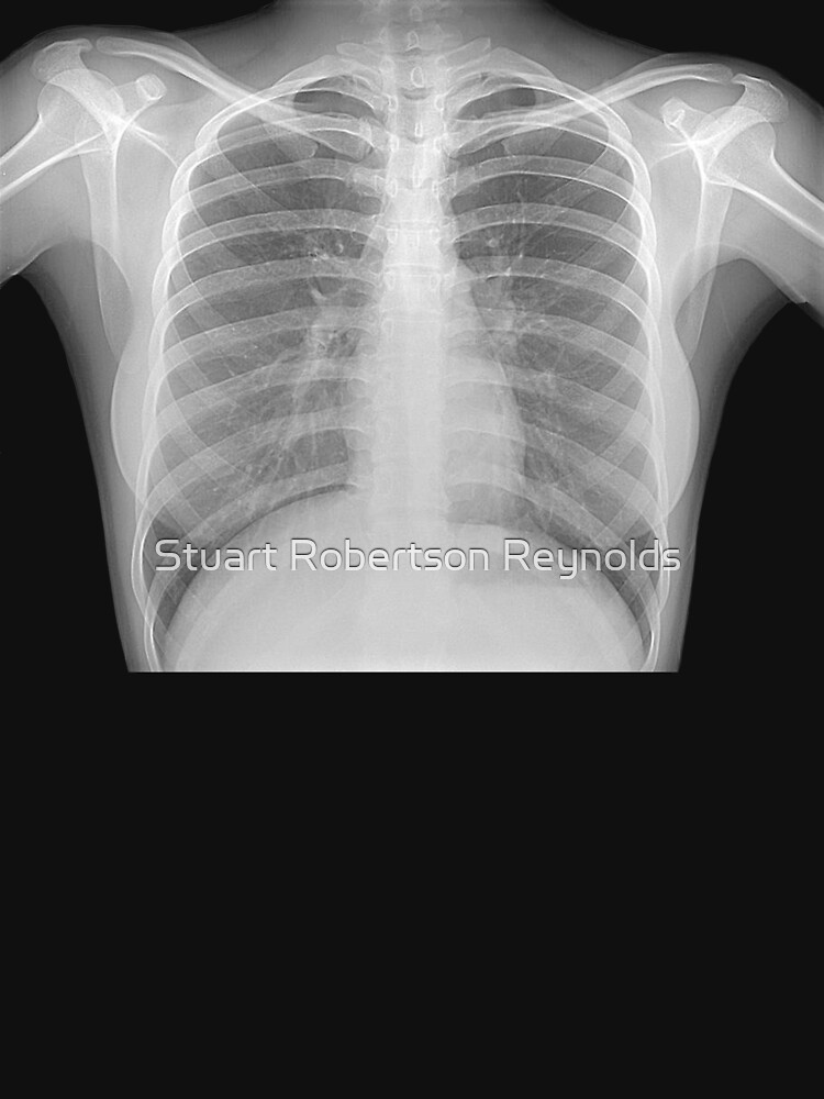 Female X Ray by Sparky2000