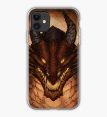 King iPhone Case