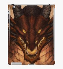 King iPad Case/Skin