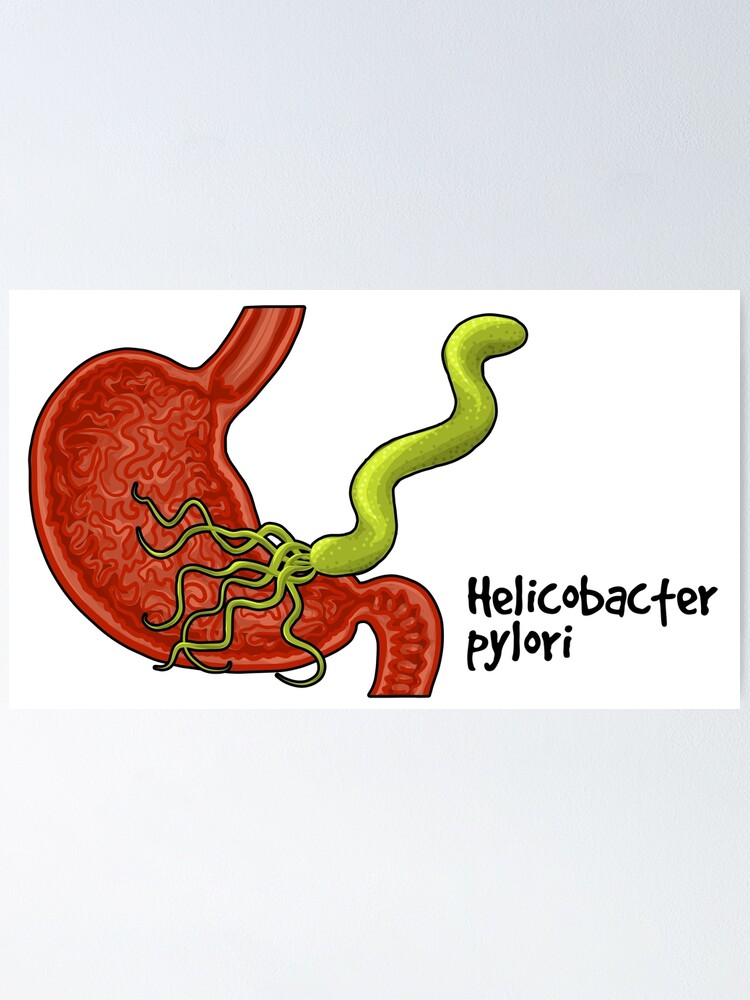 Alternate view of Helicobacter pylori Poster