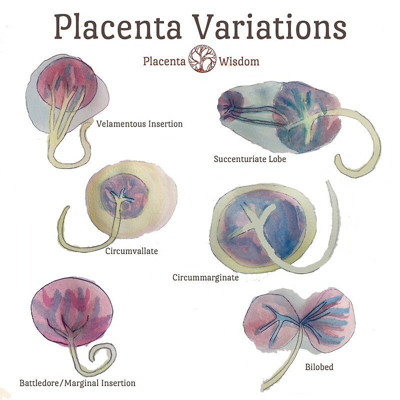 «Dibujos de acuarela de variación de placenta» de placentawisdom