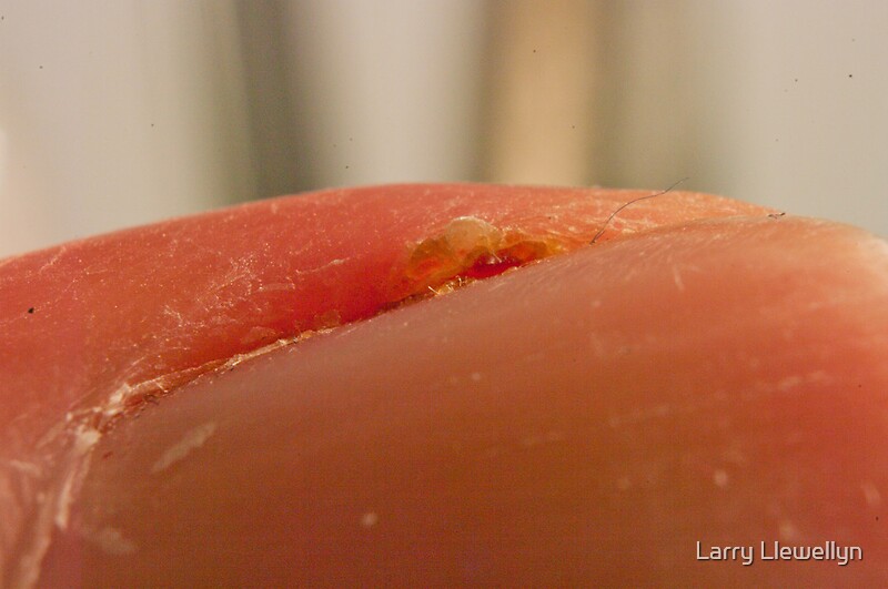 "A hANG nAIL......." by Larry Llewellyn Redbubble