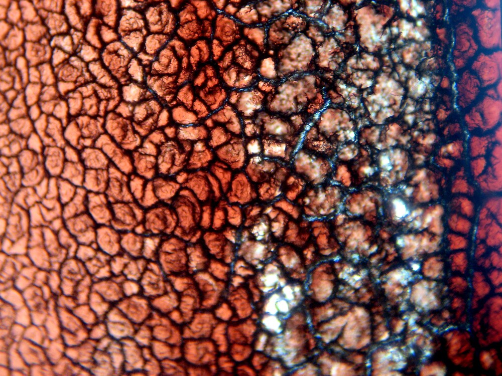 Dry Blood 400x Magnification By Rxe08 Redbubble